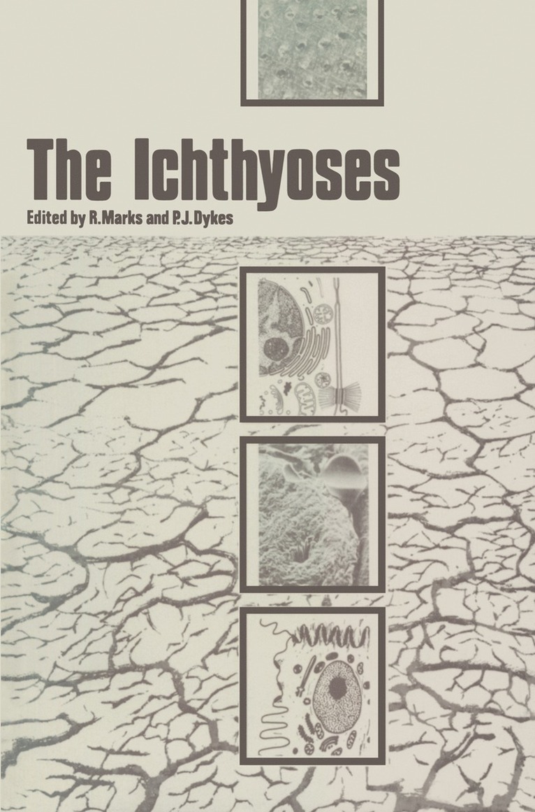 R. Marks, P.J. Dykes, P. J. Dykes - Ichthyoses, Häftad