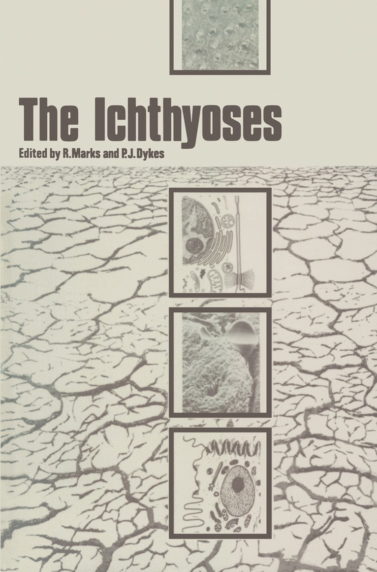 The Ichthyoses 1