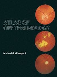 bokomslag Atlas of Ophthalmology