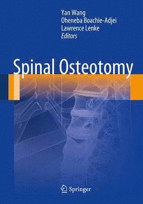 Spinal Osteotomy 1