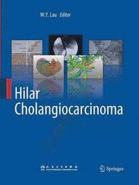 bokomslag Hilar Cholangiocarcinoma
