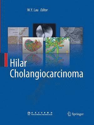bokomslag Hilar Cholangiocarcinoma