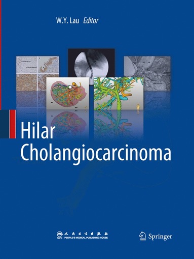 bokomslag Hilar Cholangiocarcinoma