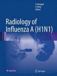 bokomslag Radiology of Influenza A (H1N1)