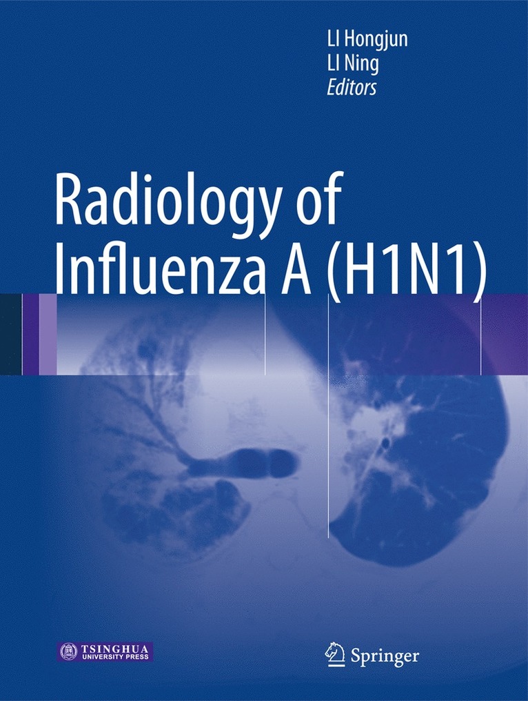 Hongjun Li, Ning Li - Radiology of Influenza A (H1N1), Häftad