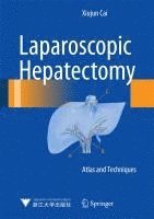 bokomslag Laparoscopic Hepatectomy