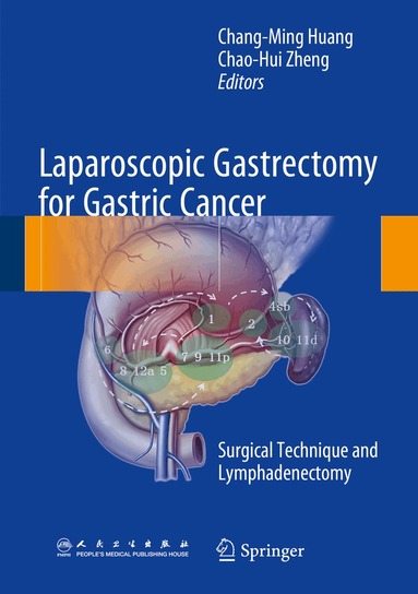 Chang-Ming Huang, Chao-Hui Zheng - Laparoscopic Gastrectomy for Gastric Cancer, Inbunden