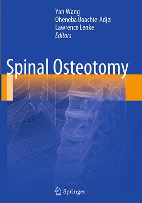 Spinal Osteotomy 1