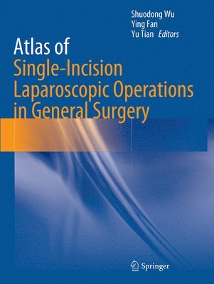Shuodong Wu, Ying Fan, Yu Tian - Atlas of Single-Incision Laparoscopic Operations in General Surgery, Häftad