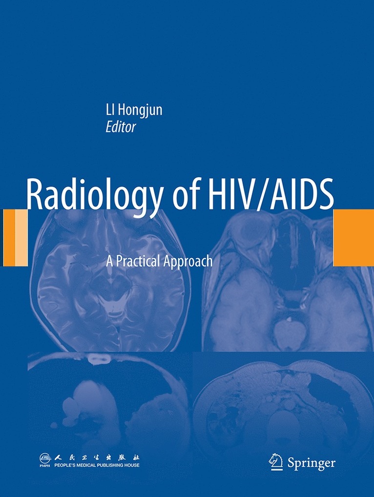Hongjun Li - Radiology of HIV/AIDS, Häftad