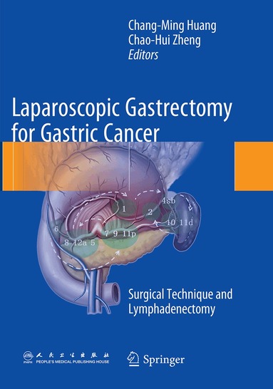 Chang-Ming Huang, Chao-Hui Zheng - Laparoscopic Gastrectomy for Gastric Cancer, Häftad
