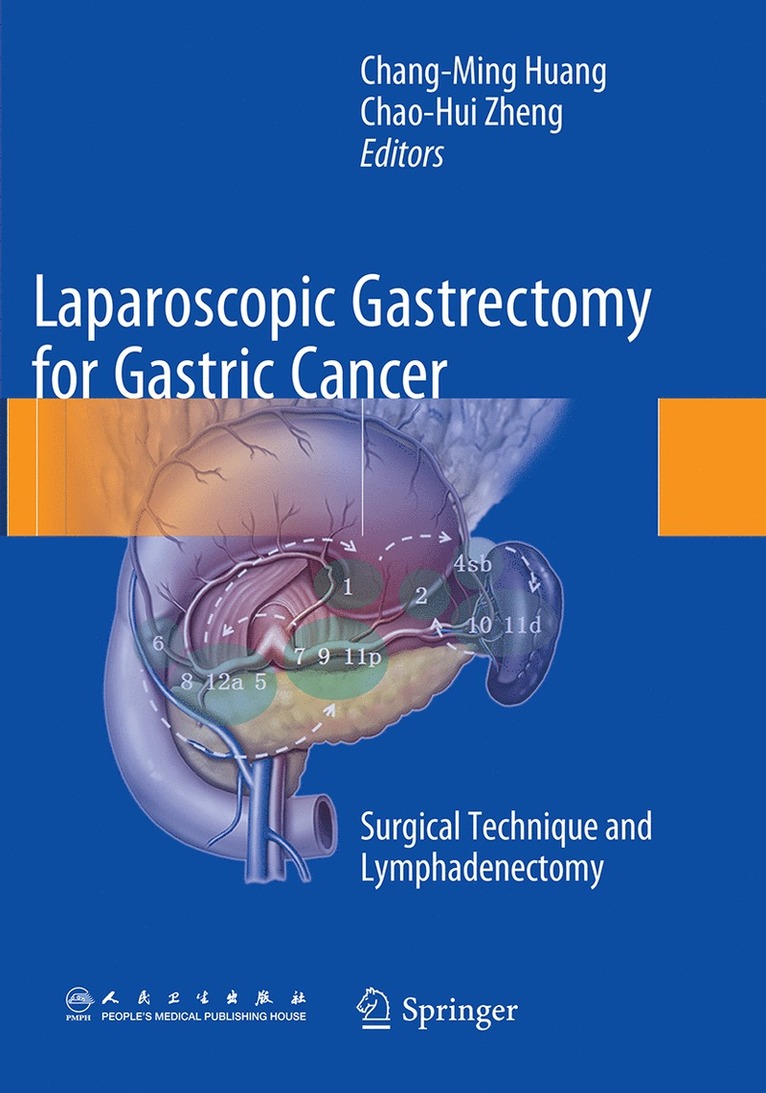 Chang-Ming Huang, Chao-Hui Zheng - Laparoscopic Gastrectomy for Gastric Cancer, Häftad
