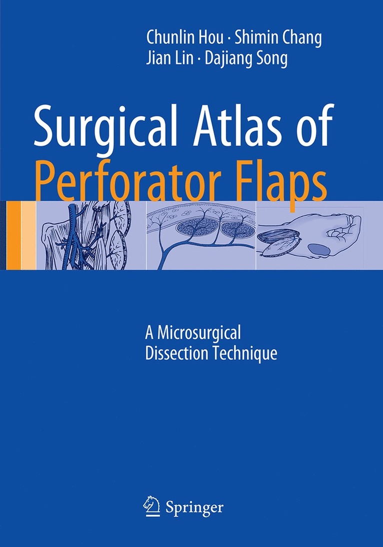 Chunlin Hou, Shimin Chang, Jian Lin, Dajiang Song - Surgical Atlas of Perforator Flaps, Häftad