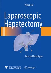 bokomslag Laparoscopic Hepatectomy