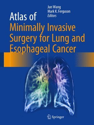 Atlas of Minimally Invasive Surgery for Lung and Esophageal Cancer 1