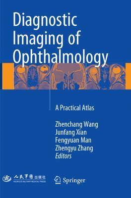 Zhenchang Wang, Junfang Xian, Fengyuan Man, Zhengyu Zhang - Diagnostic Imaging of Ophthalmology, Häftad