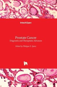 bokomslag Prostate Cancer