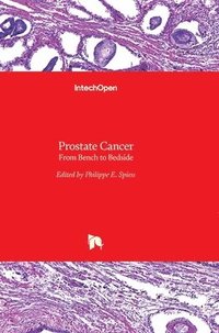 bokomslag Prostate Cancer