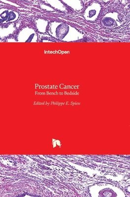 Philippe E. Spiess - Prostate Cancer, Inbunden