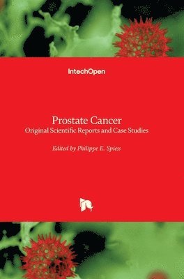 Philippe E. Spiess - Prostate Cancer, Inbunden