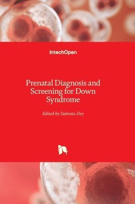 Subrata Dey - Prenatal Diagnosis and Screening for Down Syndrome, Inbunden