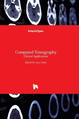 bokomslag Computed Tomography