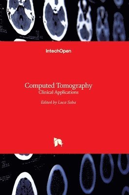 Luca Saba - Computed Tomography, Inbunden