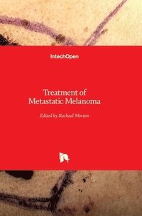 bokomslag Treatment of Metastatic Melanoma