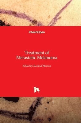 bokomslag Treatment Of Metastatic Melanoma