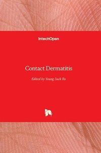 bokomslag Contact Dermatitis