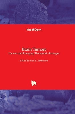 bokomslag Brain Tumors