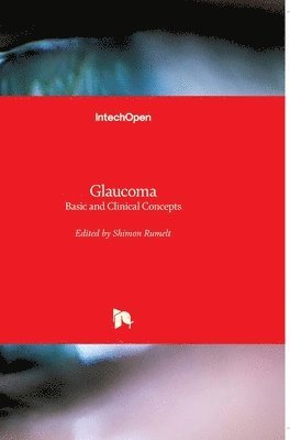 bokomslag Glaucoma