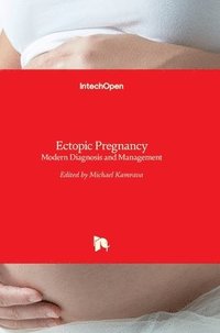 bokomslag Ectopic Pregnancy