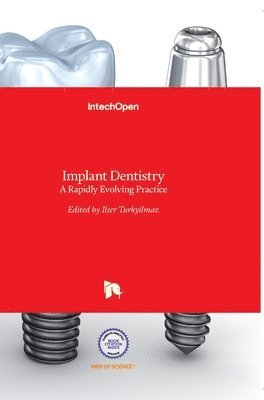 Ilser Turkyilmaz - Implant Dentistry, Inbunden