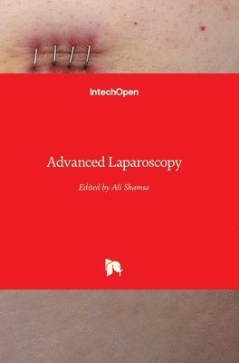 bokomslag Advanced Laparoscopy