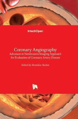 bokomslag Coronary Angiography