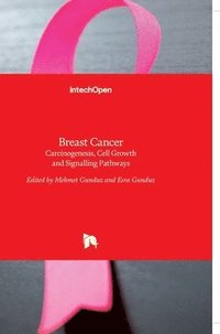 bokomslag Breast Cancer