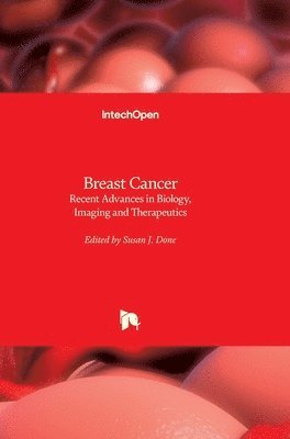 bokomslag Breast Cancer