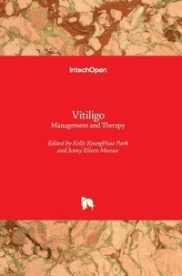 bokomslag Vitiligo: Management and Therapy