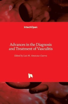 Luis M. Amezcua-Guerra, Luis M Amezcua-Guerra - Advances in the Diagnosis and Treatment of Vasculitis, Inbunden