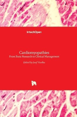 Cardiomyopathies