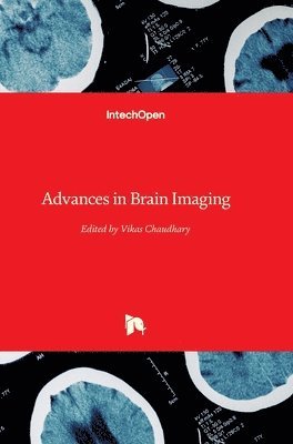 Vikas Chaudhary - Advances in Brain Imaging, Inbunden
