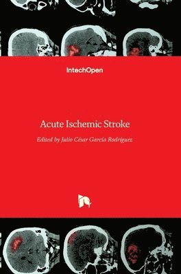 Acute Ischemic Stroke 1