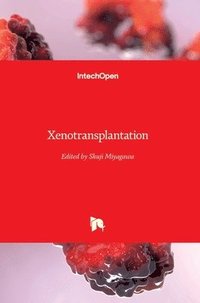 bokomslag Xenotransplantation