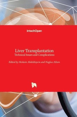 bokomslag Liver Transplantation