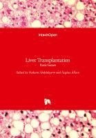 bokomslag Liver Transplantation: Basic Issues