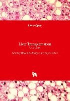 Naglaa Allam, Hesham Abdeldayem - Liver Transplantation: Basic Issues, Inbunden