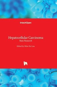 bokomslag Hepatocellular Carcinoma: Basic Research