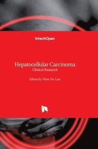 bokomslag Hepatocellular Carcinoma: Clinical Research