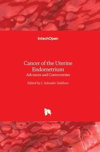 bokomslag Cancer Of The Uterine Endometrium